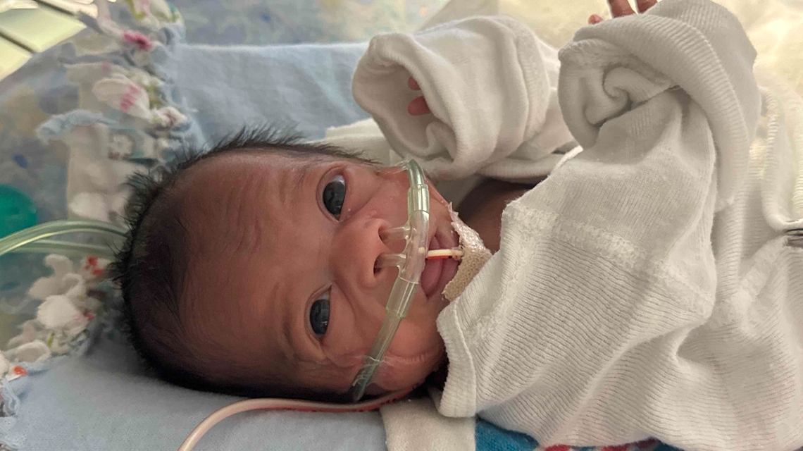 Born at an estimated 20 to 22 weeks gestation, Leilani spent four months in the NICU before being released in May. She returned home on oxygen and was later cleared for daytime use without it.