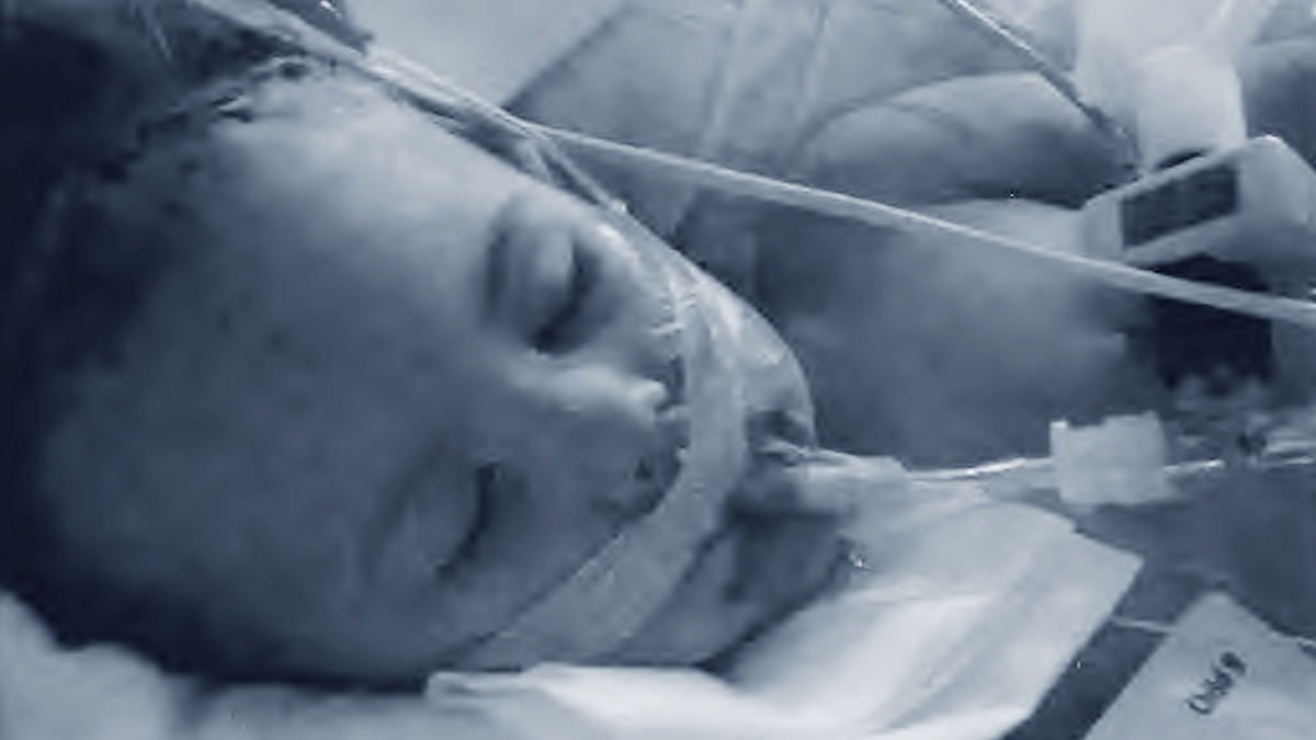 Kilah in the hospital following the severe injuries she suffered. This heartbreaking image became a powerful symbol of the fight for justice and the urgent need for stronger child protection laws.